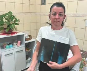 Imagem ilustrativa da imagem "A maior sequela ficou na mente", conta servidora que sobreviveu a acidente