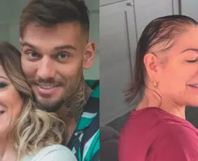 Imagem ilustrativa da imagem Alopecia: causas e tratamentos da doença que afeta famosos