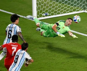 Imagem ilustrativa da imagem Goleiro da Argentina diz sentir dor nas mãos todos os dias