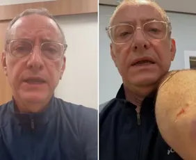 Imagem ilustrativa da imagem Jornalista José Roberto Burnier é atacado por pitbull: 'irresponsabilidade'