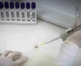 Imagem ilustrativa da imagem Secretaria de Saúde de SP investiga novo caso suspeito de ebola