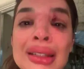 Imagem ilustrativa da imagem Suposta violência patrimonial contra dentista agredida por empresário é investigada