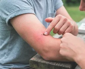 Imagem ilustrativa da imagem Alergias graves levam pacientes à UTI e podem até matar
