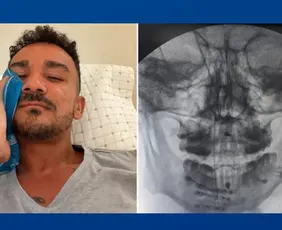 Imagem ilustrativa da imagem Danilo, do Flamengo, mostra recuperação após fratura na mandíbula