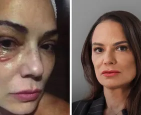 Imagem ilustrativa da imagem Luiza Brunet comenta indenização de R$ 150 mil por agressão de ex
