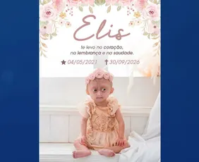 Imagem ilustrativa da imagem Morre Elis, gêmea com síndrome de envelhecimento precoce; entenda a doença