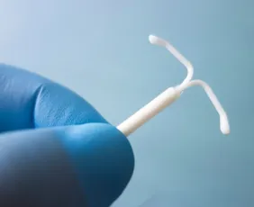 Imagem ilustrativa da imagem Planos de saúde terão que cobrir DIU hormonal em casos de endometriose