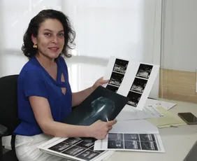 Imagem ilustrativa da imagem Planos de saúde vão cobrir mamografia sem restrição de idade; saiba mais