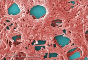 Imagem ilustrativa da imagem Helicobacter Pylori