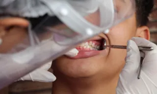 Imagem ilustrativa da imagem Programa que garante tratamento odontológico pelo SUS é relançado no País
