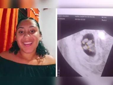 Imagem ilustrativa da imagem Jovem descobre que está grávida de quíntuplos e chega a passar mal em ultrassom