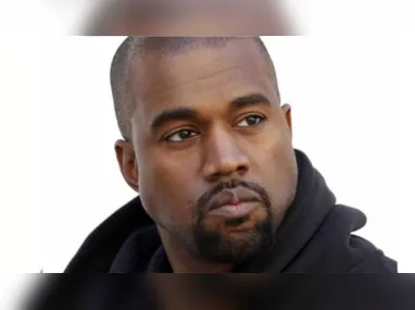 Imagem ilustrativa da imagem Kanye West coloca prótese de titânio de R$ 4 milhões nos dentes