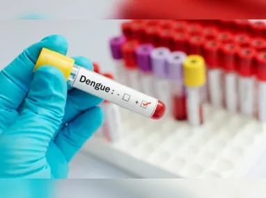 Imagem ilustrativa da imagem Planos de saúde devem cobrir exame de dengue? Entenda o que fazer