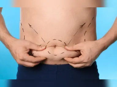 Imagem ilustrativa da imagem Lipo UltraHD: conheça a cirurgia para quem busca “barriga de tanquinho”