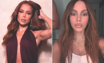 Imagem ilustrativa da imagem Novos procedimentos de Anitta priorizam naturalidade, dizem especialistas