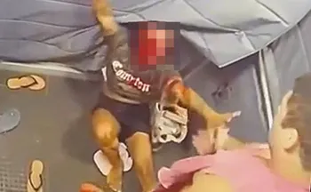 Imagem ilustrativa da imagem Homem é preso por agredir namorada com mais de 60 socos no rosto dentro de elevador