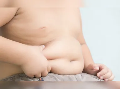 Imagem ilustrativa da imagem Mais de 10 mil casos de obesidade infantil no Espírito Santo