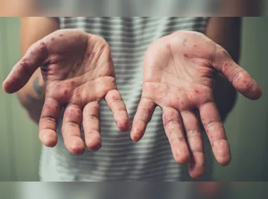 Mortes violentas no Brasil chegam a mínima histórica