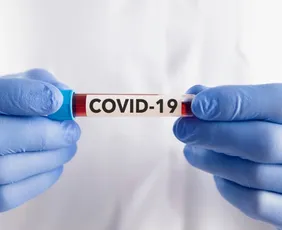 Imagem ilustrativa da imagem Surto de Covid-19 em hospital de Porto Alegre deixa dois mortos e 65 infectados
