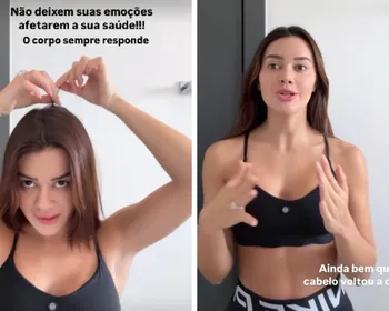 Imagem ilustrativa da imagem Franciny Ehlke revela que perdeu cabelo por estresse e fala sobre alopecia
