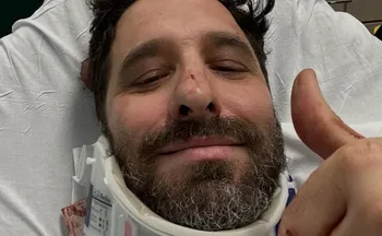 Imagem ilustrativa da imagem Rafinha Bastos sofre acidente em Nova York e é hospitalizado