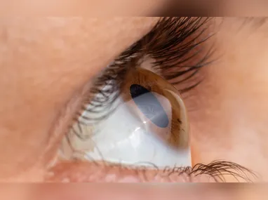 Imagem ilustrativa da imagem Dobra tempo de espera por cirurgia de transplante de córnea no Brasil