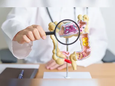 Imagem ilustrativa da imagem Estudo estima que número de mortes por câncer colorretal pode aumentar em 36,3%
