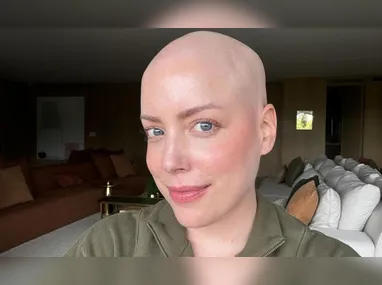 Imagem ilustrativa da imagem Fabiana Justus revela que realizou transplante pelo SUS: 'Dinheiro não compra'