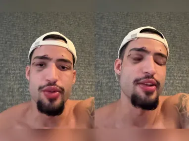 Imagem ilustrativa da imagem ‘Não sei o que aconteceu’, diz brasileiro após incidente em piscina na Grécia