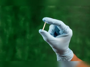 Imagem ilustrativa da imagem Planos de saúde já são obrigados a cobrir implante contraceptivo Implanon