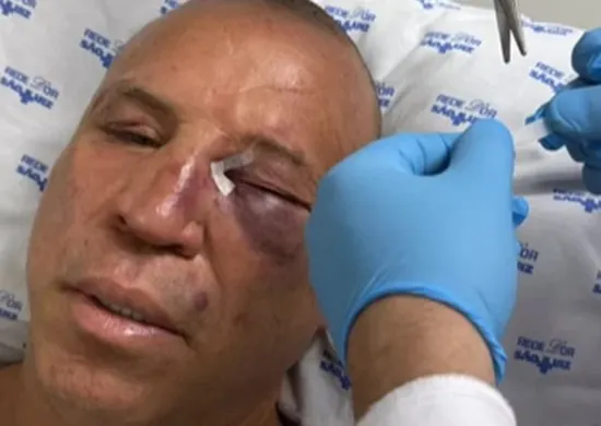 Imagem ilustrativa da imagem Wanderlei Silva teve nariz quebrado e recebeu pontos em briga após luta contra Popó