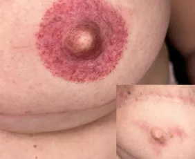 Imagem ilustrativa da imagem Projeto social leva tatuagem restauradora e ações de inclusão à Fenahall 2026