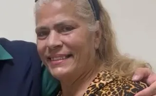 Imagem ilustrativa da imagem Ex-chacrete morre após um mês internada por ataque de pitbull do filho