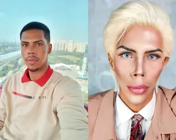 Imagem ilustrativa da imagem Ex-Ken Humano relata crise, pede ajuda e diz temer viver nas ruas