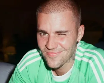 Imagem ilustrativa da imagem Justin Bieber relata queda de skate elétrico: "Até cantar, rir, tudo dói"