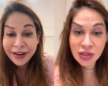 Imagem ilustrativa da imagem Maíra Cardi exibe rosto deformado após botox dar errado: 'Olha que palhaçada'