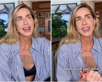 Imagem ilustrativa da imagem Mariana Weickert relata descoberta de câncer de pele