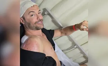 Imagem ilustrativa da imagem Após atropelamento grave em 2023, Kayky Brito se envolve em novo acidente