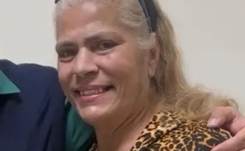 Imagem ilustrativa da imagem Ex-chacrete morre após um mês internada por ataque de pitbull do filho