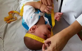 Imagem ilustrativa da imagem INSS paga pensão vitalícia para crianças com zika vírus