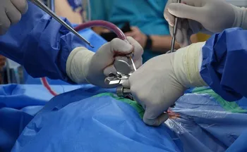 Imagem ilustrativa da imagem Justiça manda aplicar polilaminina em paciente do ES que sofreu lesão medular