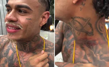 Imagem ilustrativa da imagem MC Cabelinho fica com pescoço machucado após tentativa de furto em Salvador