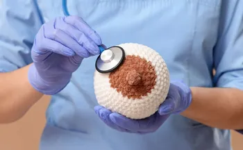 Imagem ilustrativa da imagem Por que o câncer de mama está mais comum em jovens?