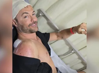 Imagem ilustrativa da imagem Após atropelamento grave em 2023, Kayky Brito se envolve em novo acidente