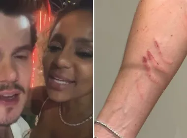 Imagem ilustrativa da imagem Cariúcha acusa médico de agressão; ele nega e afirma ter sido arranhado pela