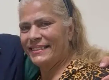 Imagem ilustrativa da imagem Ex-chacrete morre após um mês internada por ataque de pitbull do filho