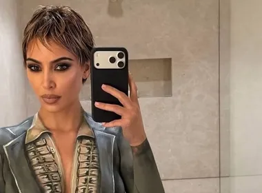 Imagem ilustrativa da imagem Kim Kardashian descobre que está com atividade cerebral reduzida