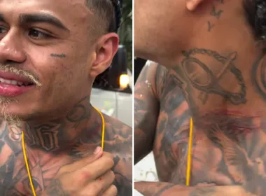 Imagem ilustrativa da imagem MC Cabelinho fica com pescoço machucado após tentativa de furto em Salvador