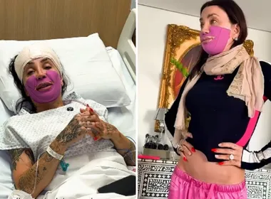 Imagem ilustrativa da imagem Maya Massafera exibe ossos que tirou do maxilar em nova cirurgia nas redes sociais