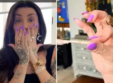 Imagem ilustrativa da imagem Maya Massafera mostra resultado após retirar ossos do rosto